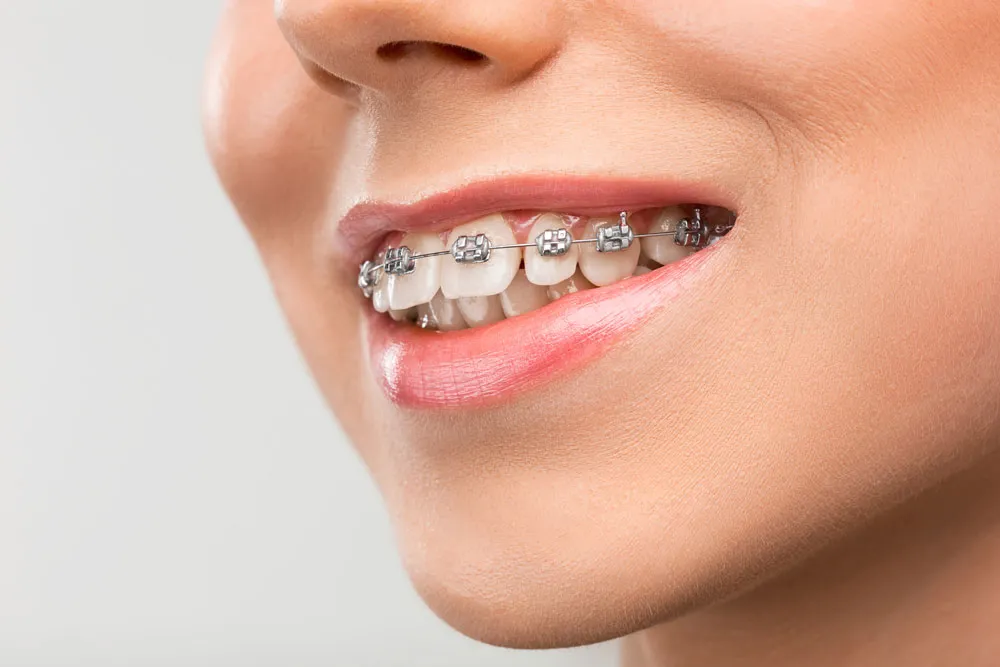 Affordable Orthodontic