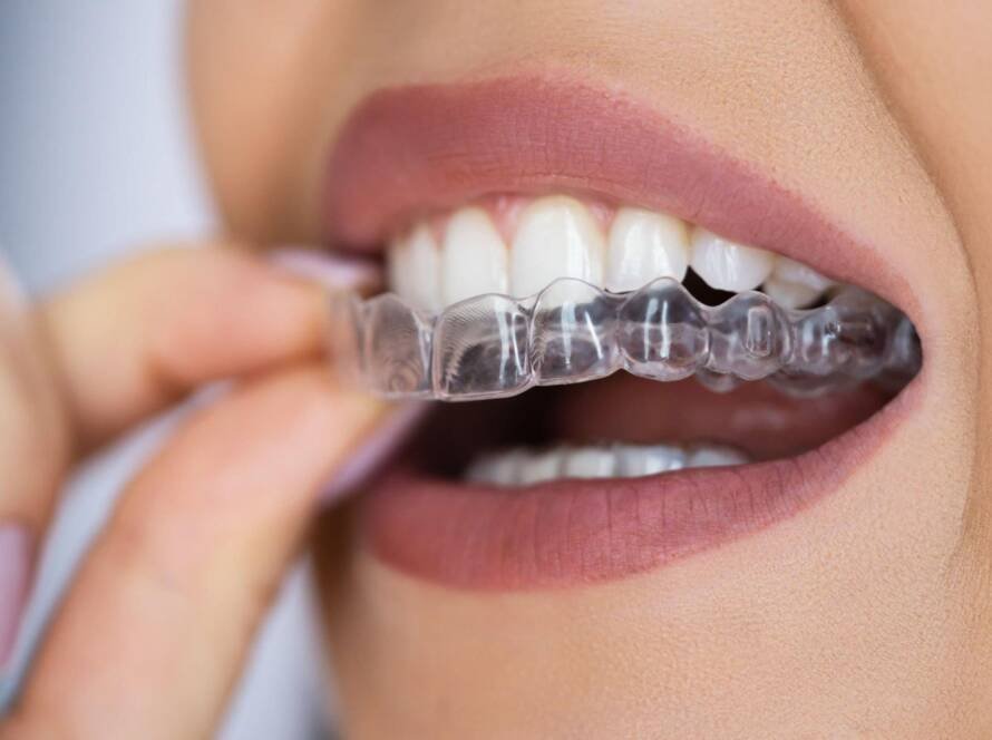 Invisalign Provider