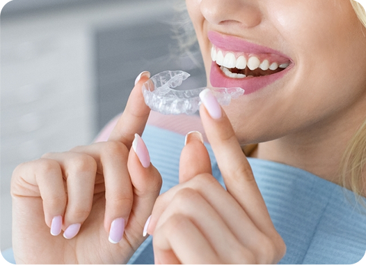 Invisalign