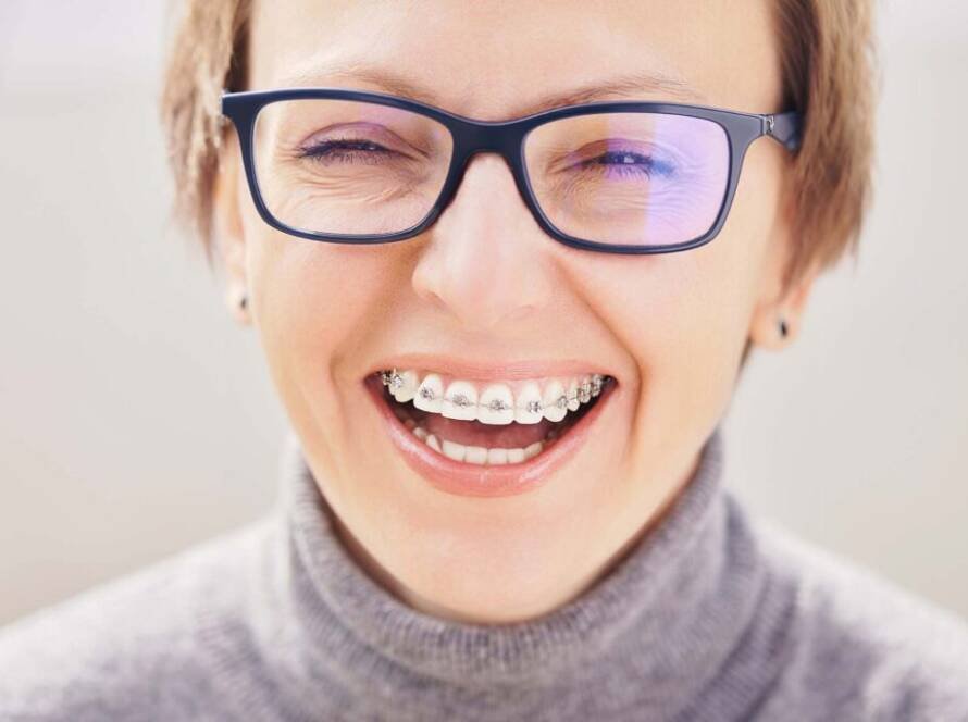 Adult Orthodontic Braces