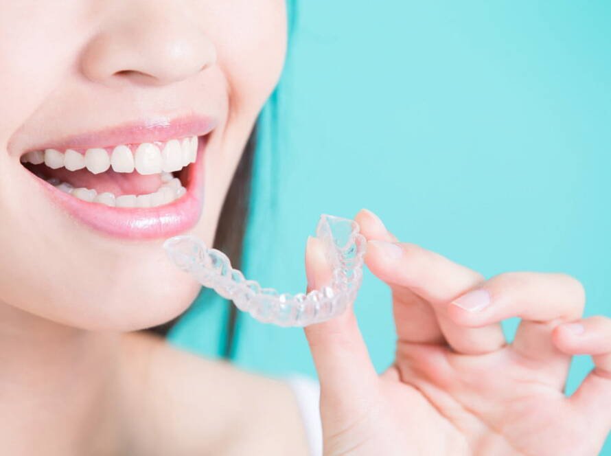 Invisalign Clear Aligners